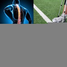 4 Fotos 1 Palavra Enigma diário Março 17 2026